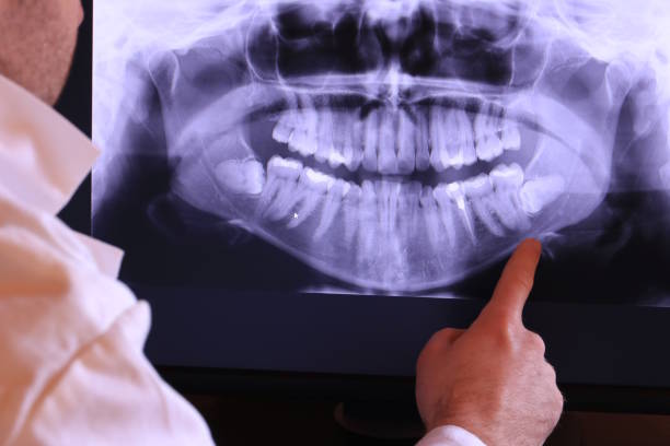 Best Knocked-Out Tooth Emergency  in St George, SC