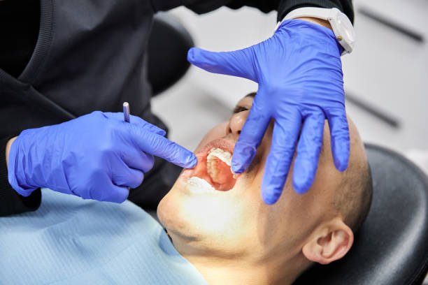 Emergency Dental Filling Replacement in SC